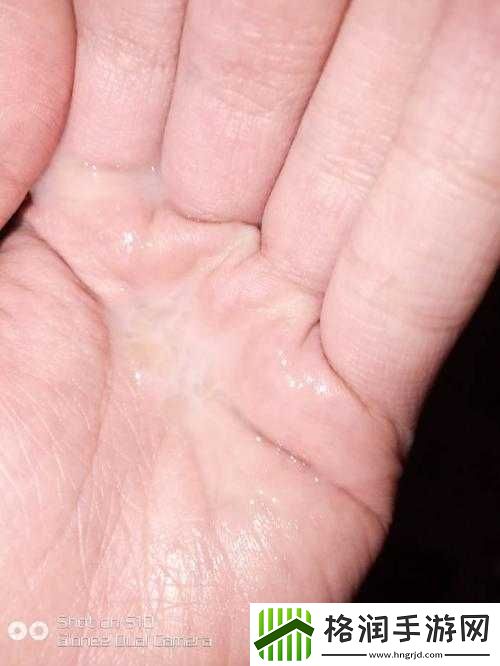 镜流口水流白色液体是否正常