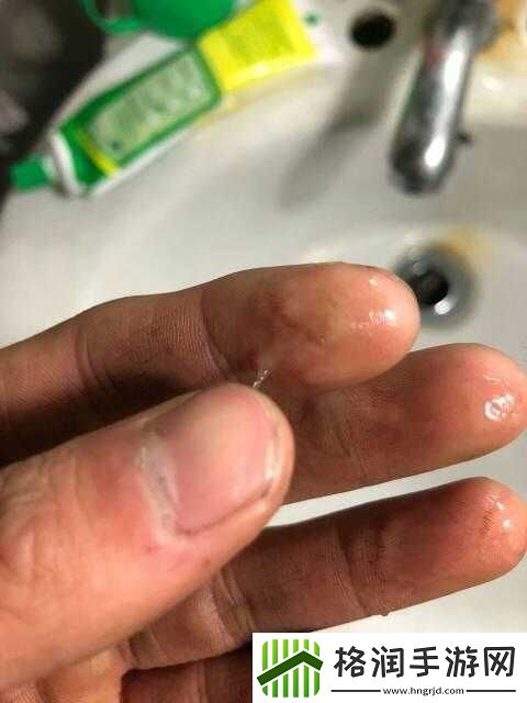 一激动下面就流透明液体怎么办