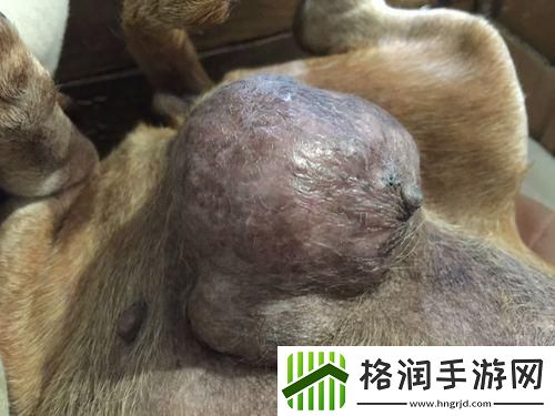 肠道突起拳头大