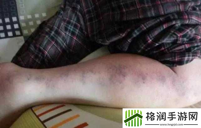 中医排阴毒疗法是否有效存疑