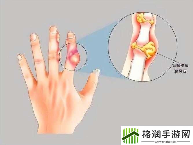 才三根手指就痛