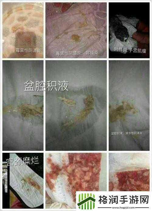 月月我这是帮你排阴毒之真相揭秘