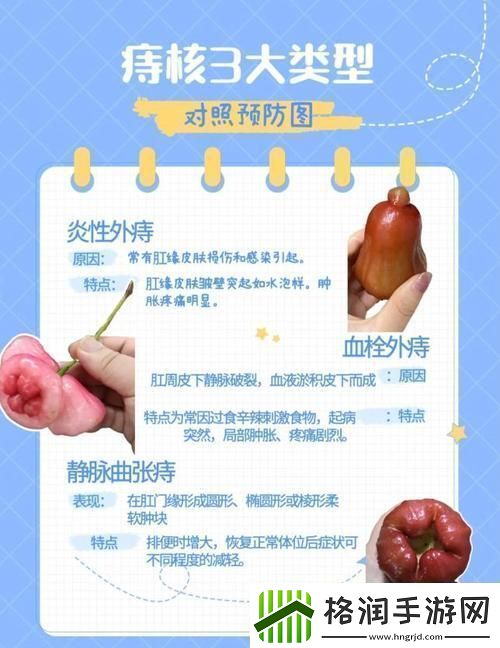 “潮流前沿”的肛门之谜