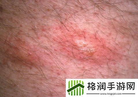 “两个蛋蛋”之谜