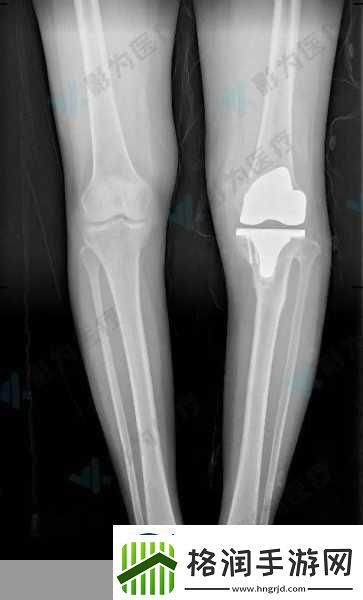 骨科新线路解析