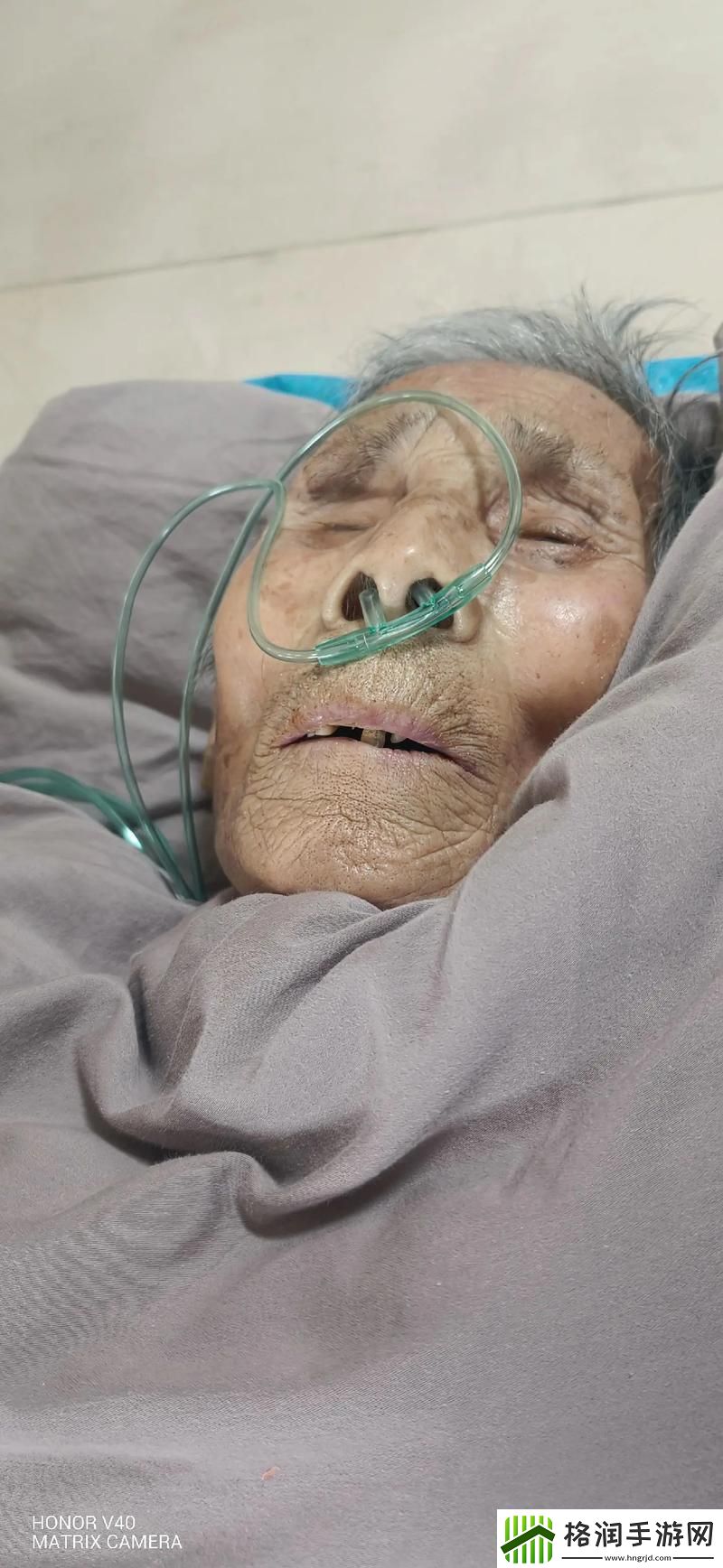 哎哟大叔我病了检查是个啥玩意儿