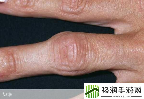 宝宝怎么才三根手指就痛1.宝宝为何三根手指就感到疼痛