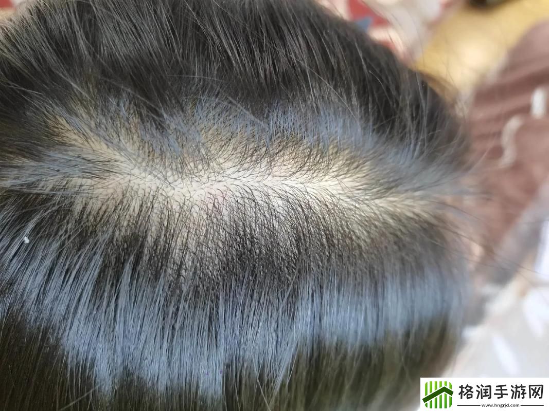 “头发生长记”