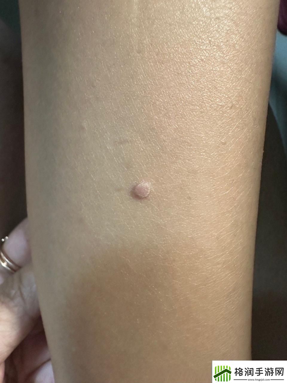 疙瘩里头硬邦邦