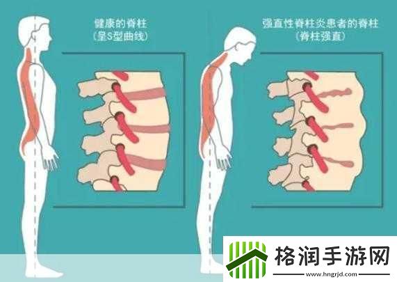 颈腰挺过那层薄膜