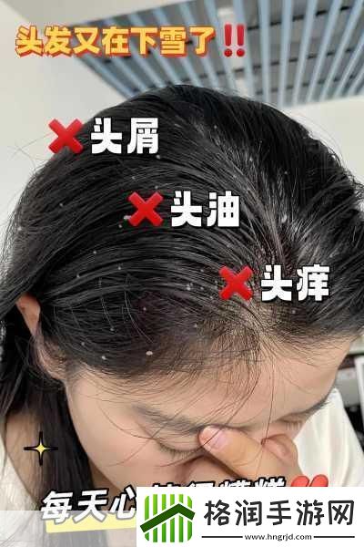 翁止熄痒最简单处理方法