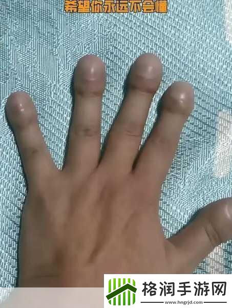 才三根手指就痛