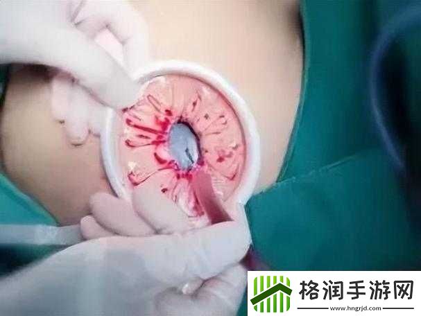 腹部灌满隆起**令人震撼的奇特景象