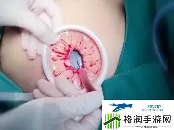 腹部灌满隆起**令人震撼的奇特景象