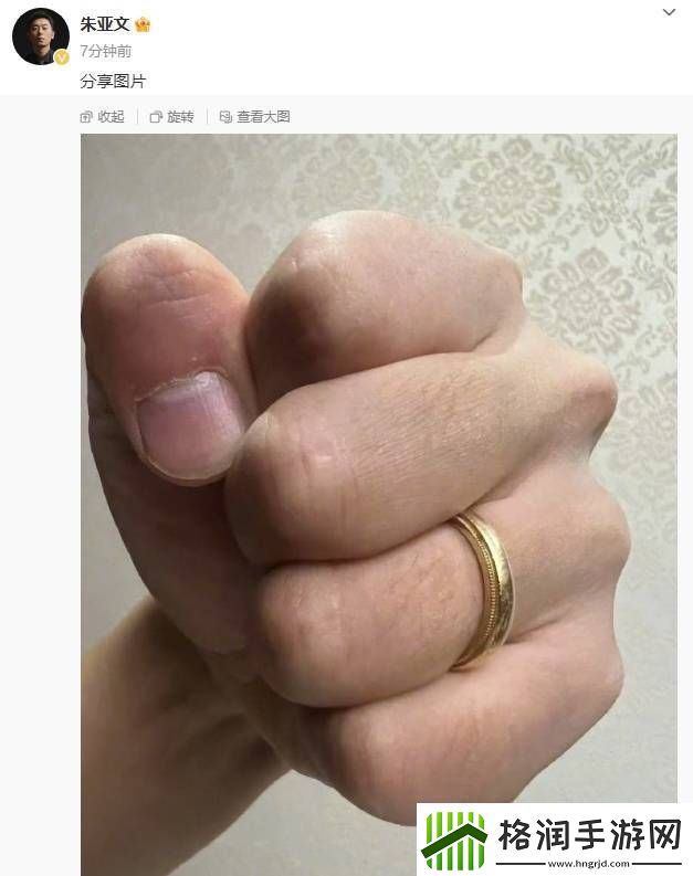 朱亚文晒手戴婚戒照片力破传的离婚谣言