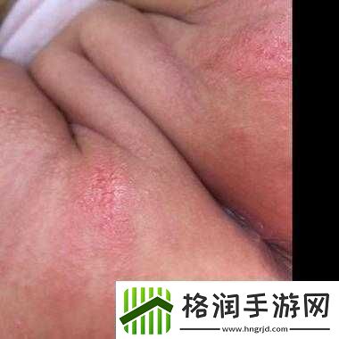 宝宝湿透还嘴硬说疼究竟是怎么回事呢